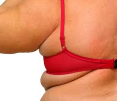 Arms (Bat Wings) + Upper Back (Bra Flaps) - 3 Series