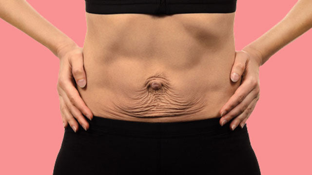 Skin Tightening