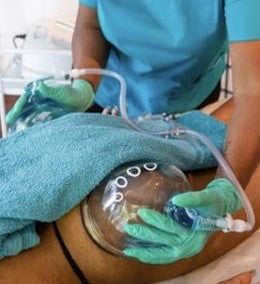 Ultrasonic Cavitation