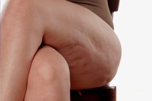 1 Cellulite Deluxe