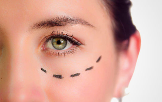 Eye Bag Removal