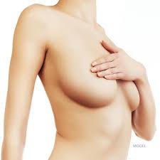 Breast Lift