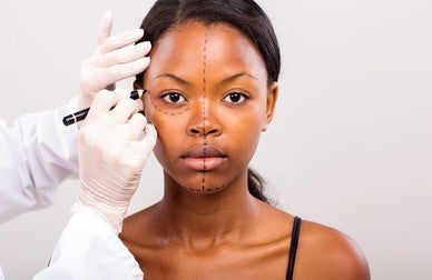 Face Lift
